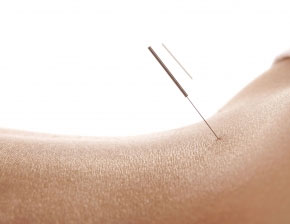 Acupuncture Therapy For Neurological Diseases