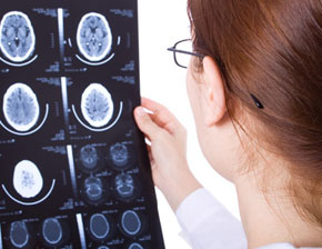 List Of Neurological Diseases
